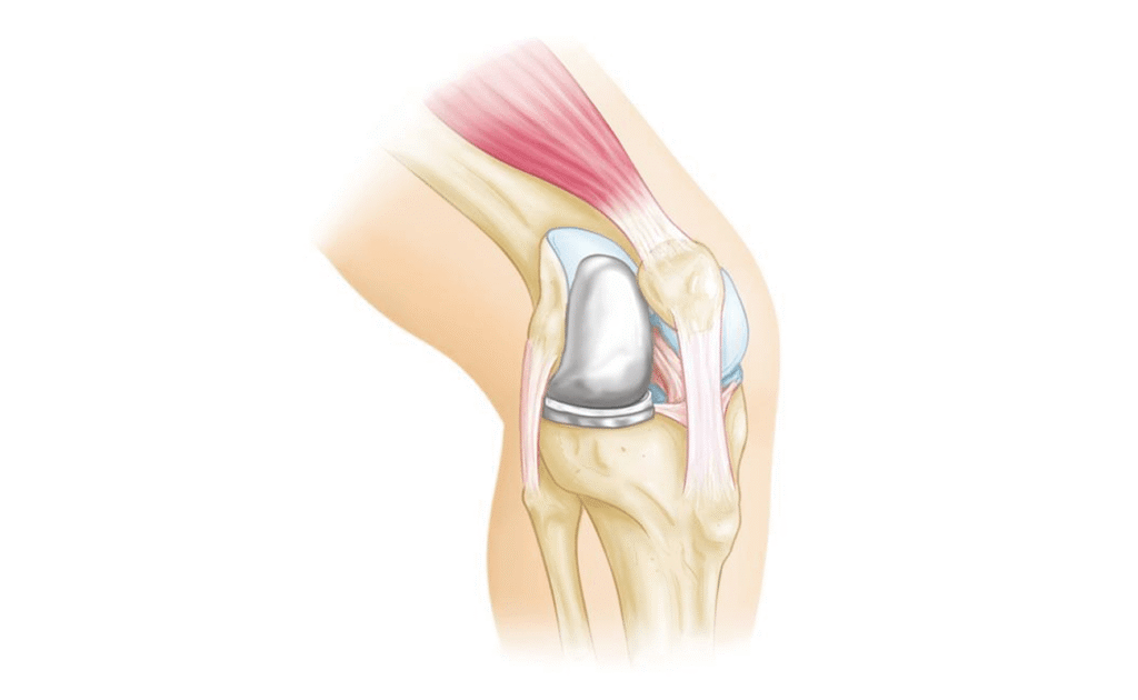 personal-knee-treatment-slider